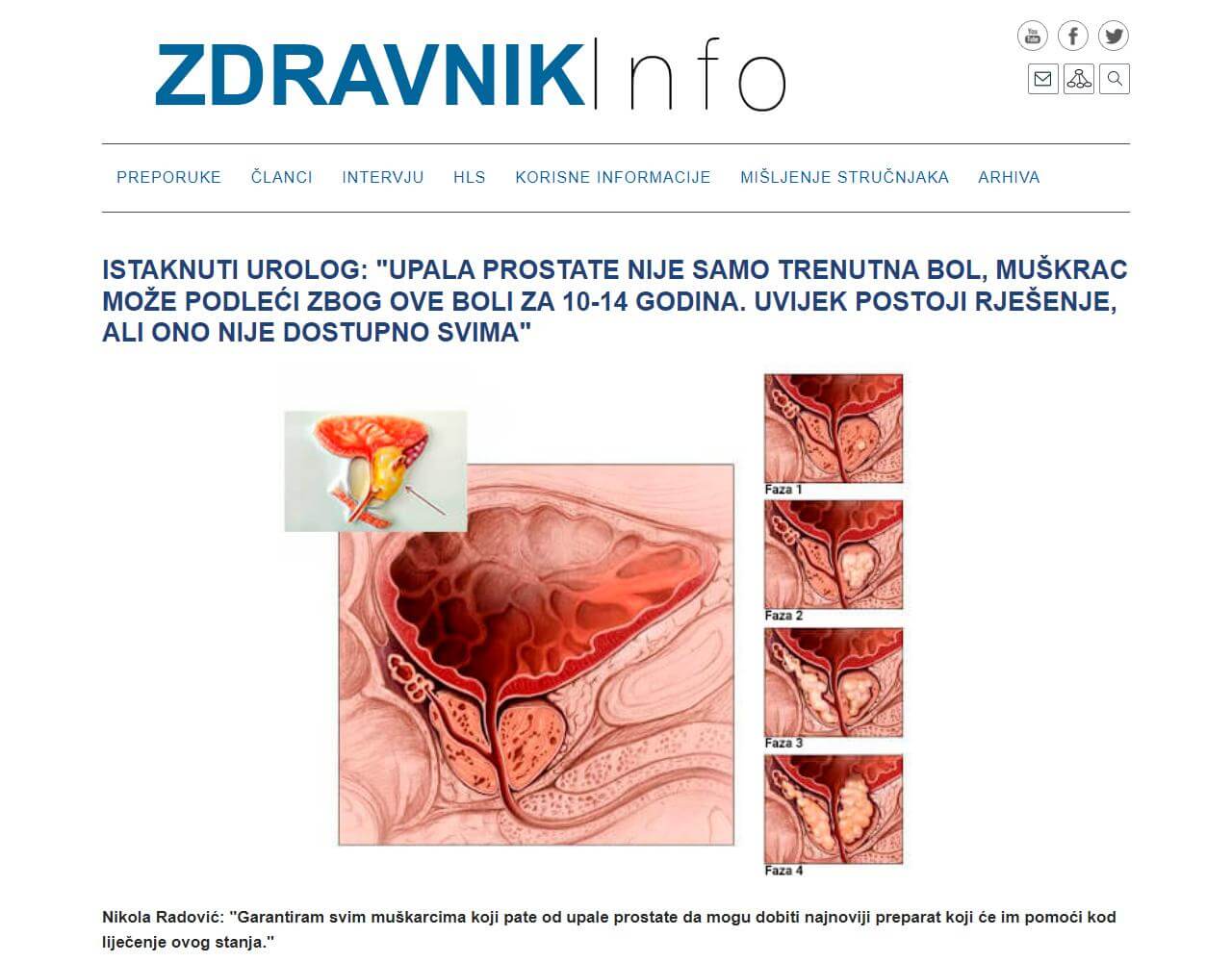 Prostatin 1